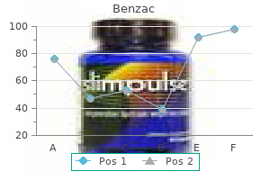 buy benzac 20 gr with amex