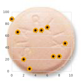 Samson Gardner syndrome