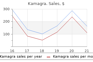 100 mg kamagra buy with mastercard