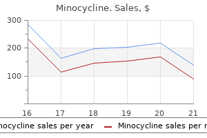 minocycline 50 mg cheap with mastercard
