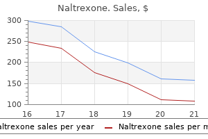 naltrexone 50 mg order free shipping