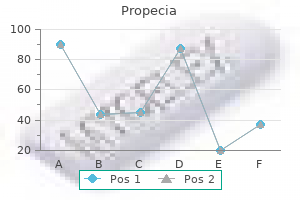 cheap 5 mg propecia fast delivery